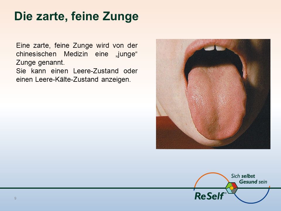 Die zarte, feine Zunge Eine zarte, feine Zunge wird von der chinesischen Medizin eine „junge Zunge genannt.