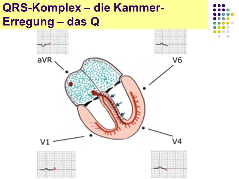 QRS-Komplex – die Kammer-Erregung – das Q