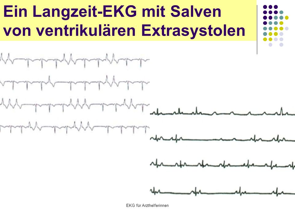 EKG für Arzthelferinnen