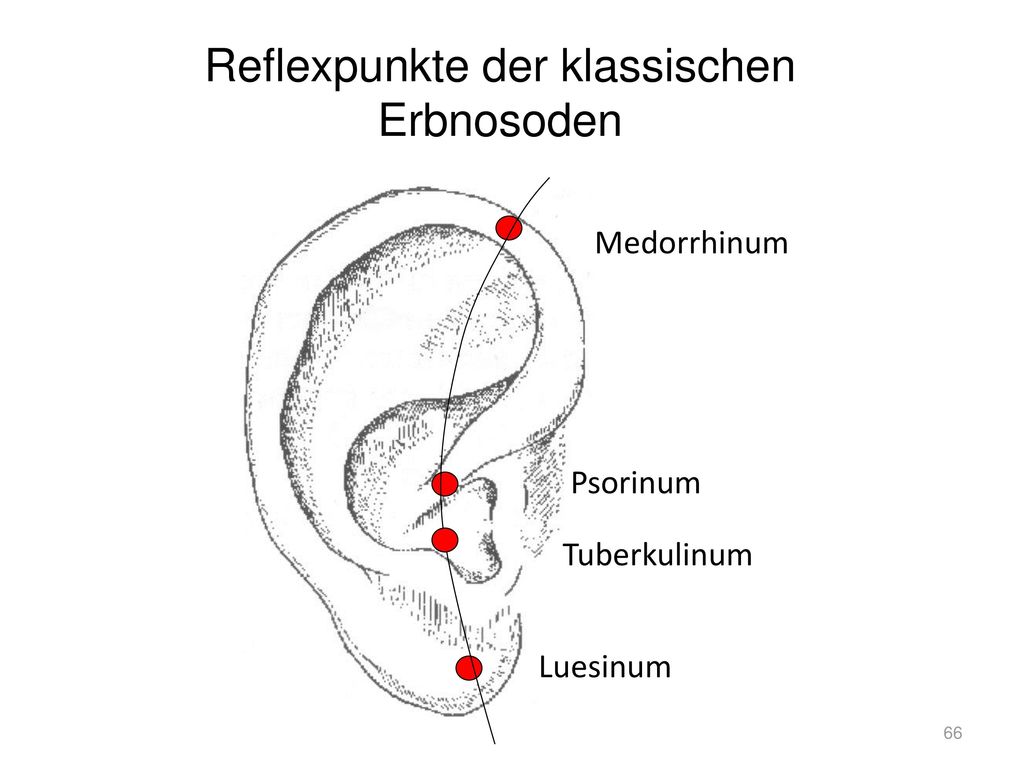 Reflexpunkte der klassischen Erbnosoden