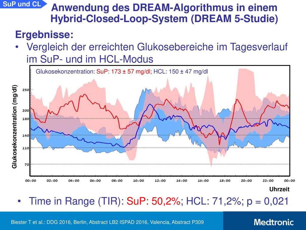 SuP und CL Anwendung des DREAM-Algorithmus in einem Hybrid-Closed-Loop-System (DREAM 5-Studie) Schlussfolgerung: