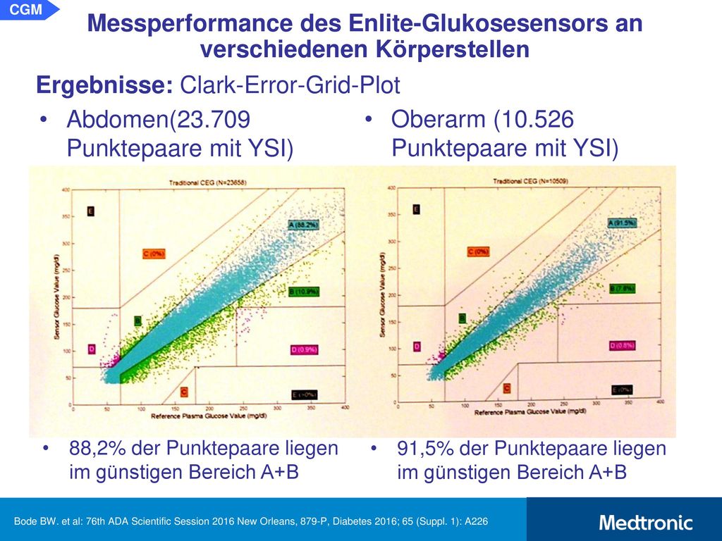 CGM Messperformance des Enlite-Glukosesensors an verschiedenen Körperstellen. Schlussfolgerung: