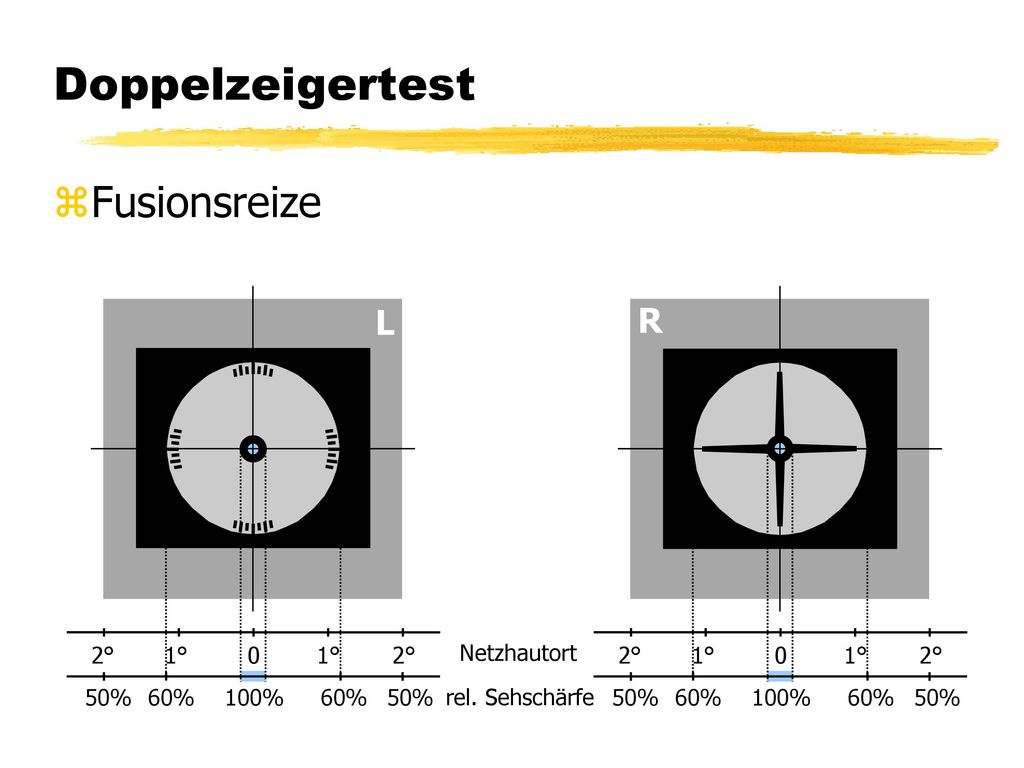 Doppelzeigertest Fusionsreize L R 1° 2° 100% 60% 50% 1° 2° Netzhautort