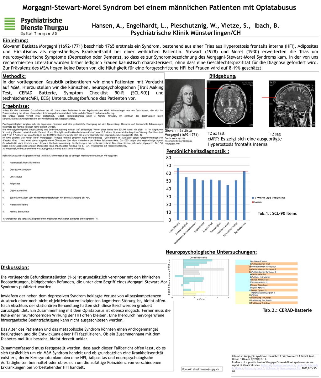 Morgagni-Stewart-Morel Syndrom bei einem männlichen Patienten mit Opiatabusus