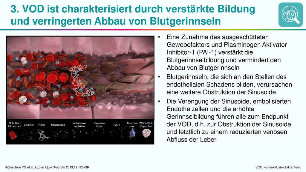 3. VOD ist charakterisiert durch verstärkte Bildung und verringerten Abbau von Blutgerinnseln