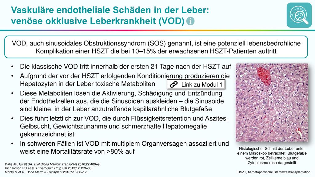 Vaskuläre endotheliale Schäden in der Leber: venöse okklusive Leberkrankheit (VOD)