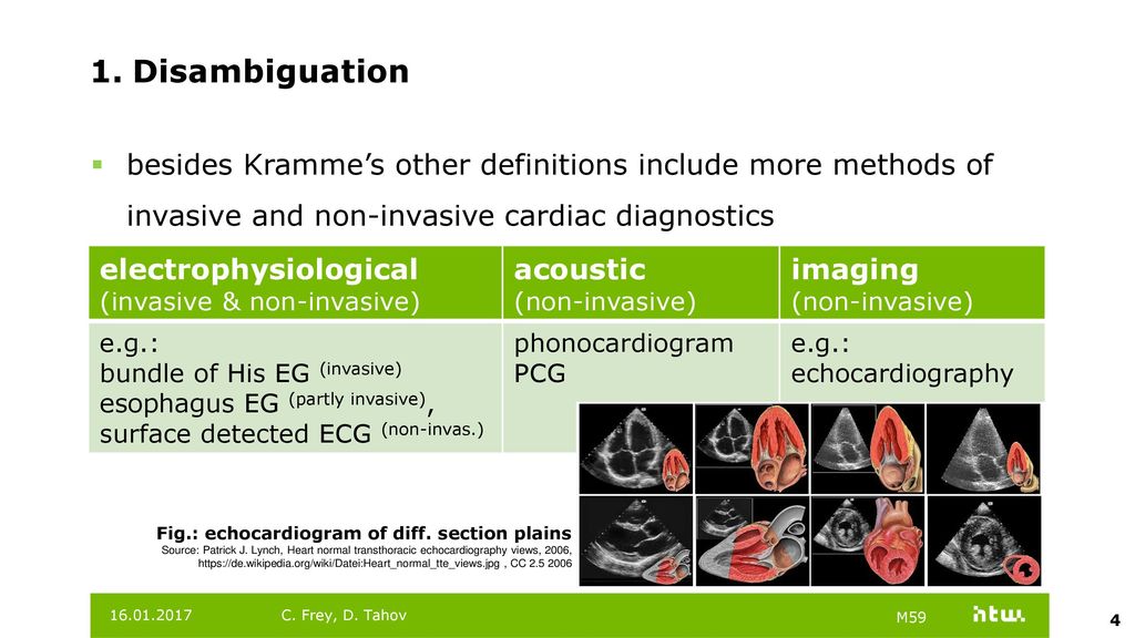 Disambiguation besides Kramme’s other definitions include more methods of invasive and non-invasive cardiac diagnostics.