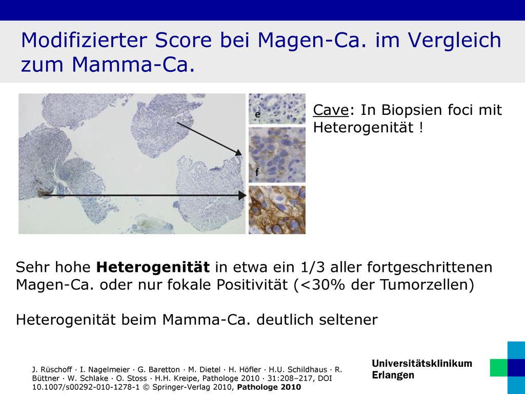 Modifizierter Score bei Magen-Ca. im Vergleich zum Mamma-Ca.