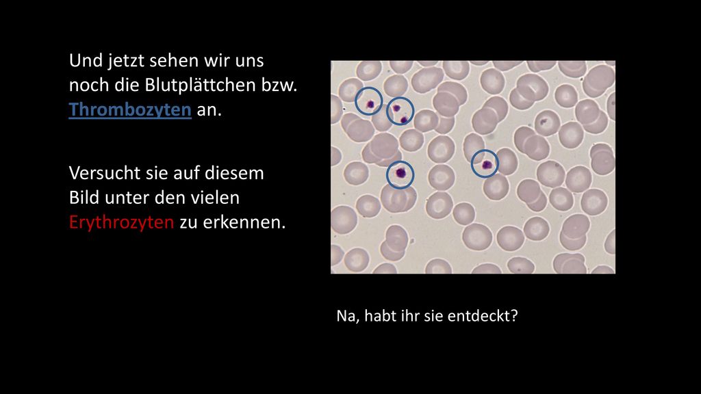 Und jetzt sehen wir uns noch die Blutplättchen bzw. Thrombozyten an.