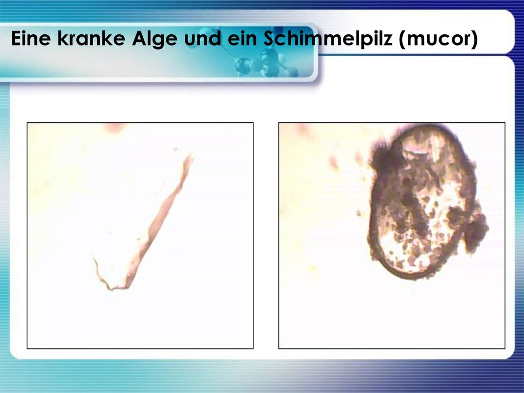 Eine kranke Alge und ein Schimmelpilz (mucor)