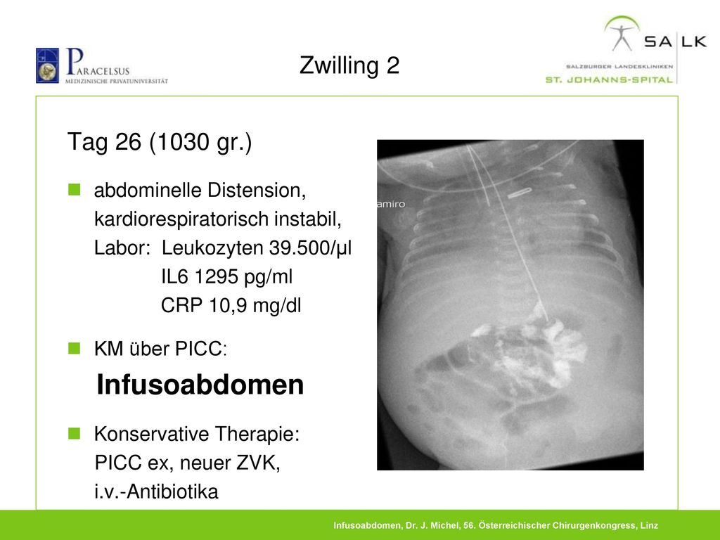 Zwilling 2 Tag 26 (1030 gr.) abdominelle Distension,