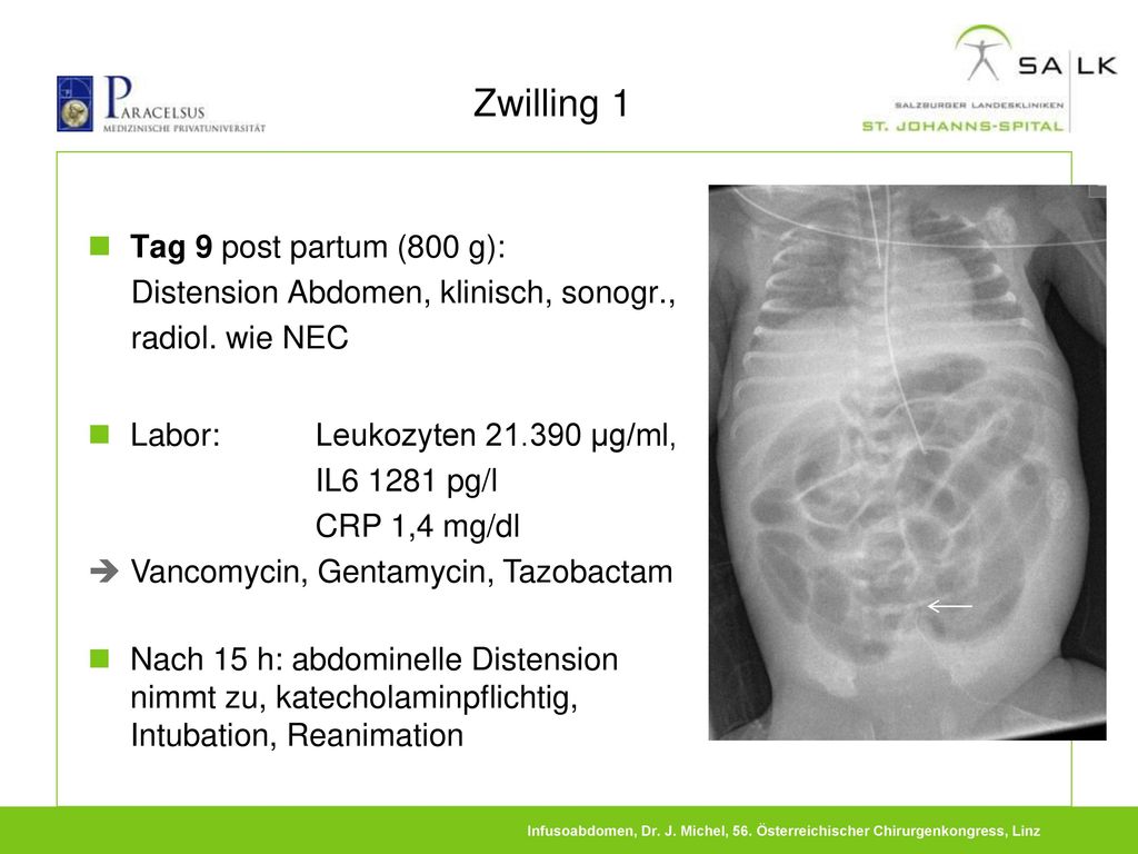 Zwilling 1 Tag 9 post partum (800 g):