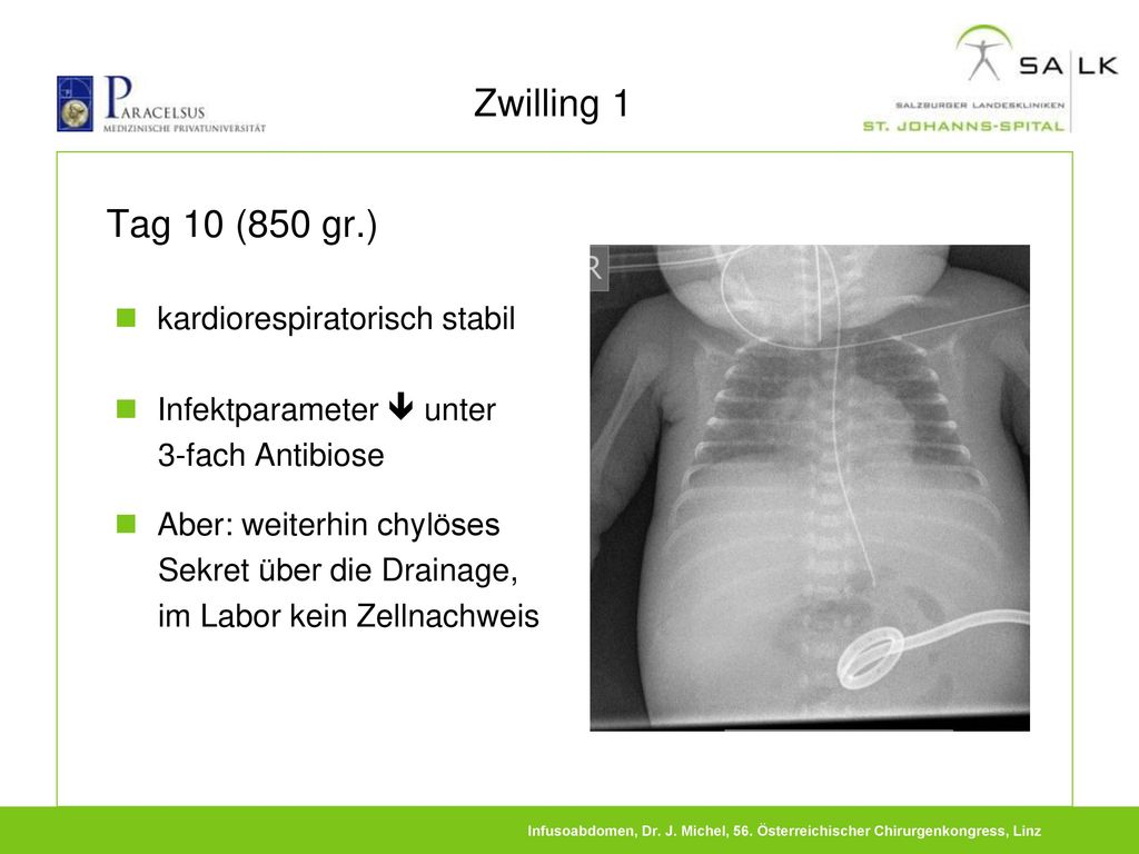 Zwilling 1 Tag 10 (850 gr.) kardiorespiratorisch stabil