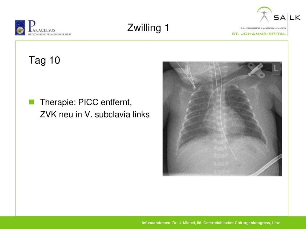 Zwilling 1 Tag 10 Therapie: PICC entfernt,