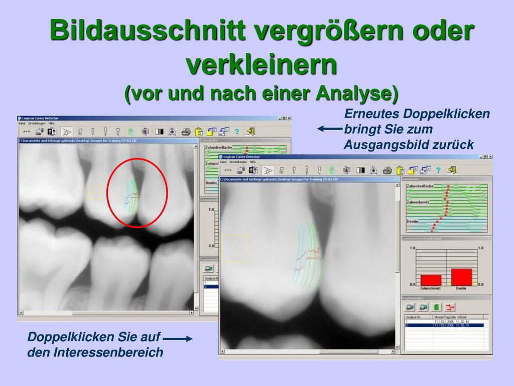 Bildausschnitt vergrößern oder verkleinern (vor und nach einer Analyse)