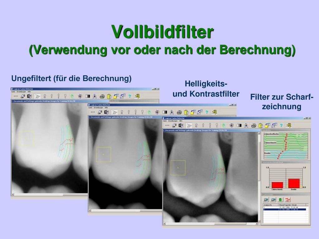 Vollbildfilter (Verwendung vor oder nach der Berechnung)