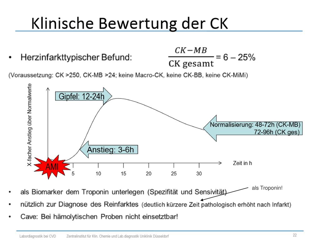 als Troponin! Labordiagnostik bei CVD Zentralinstitut für Klin. Chemie und Lab.diagnostik Uniklinik Düsseldorf.