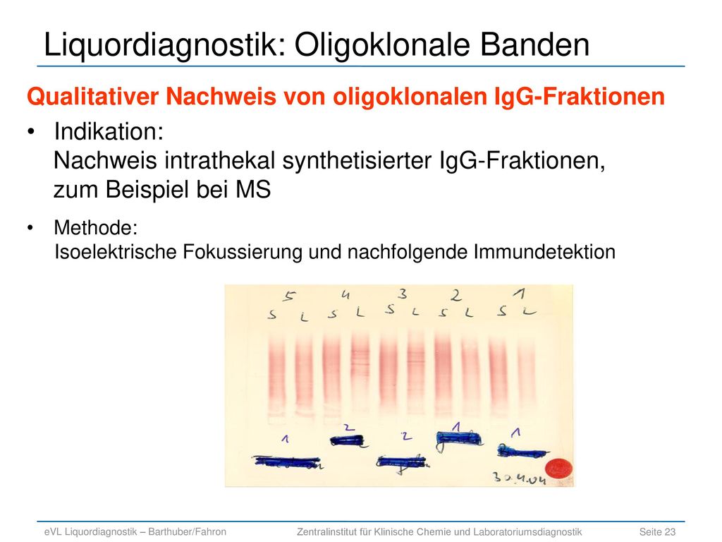 klinisch-chemischen Liquordiagnostik - ppt herunterladen