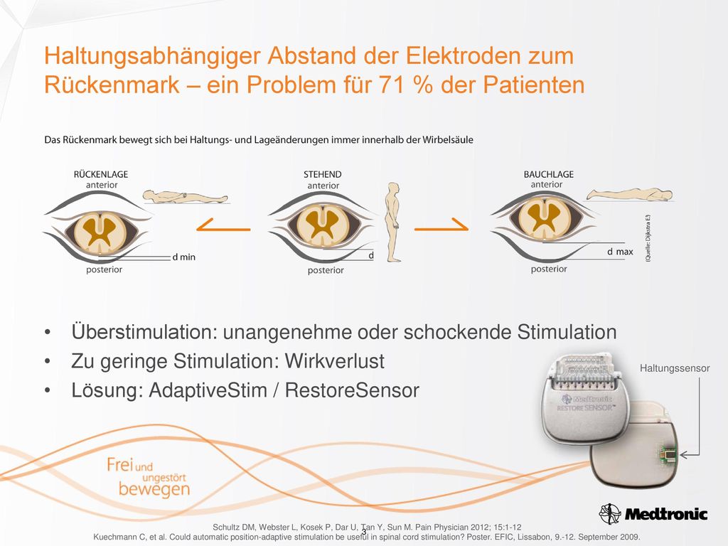 Haltungsabhängiger Abstand der Elektroden zum Rückenmark – ein Problem für 71 % der Patienten