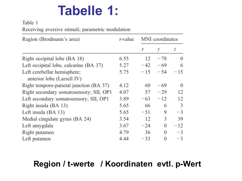 Tabelle 1: Region / t-werte / Koordinaten evtl. p-Wert