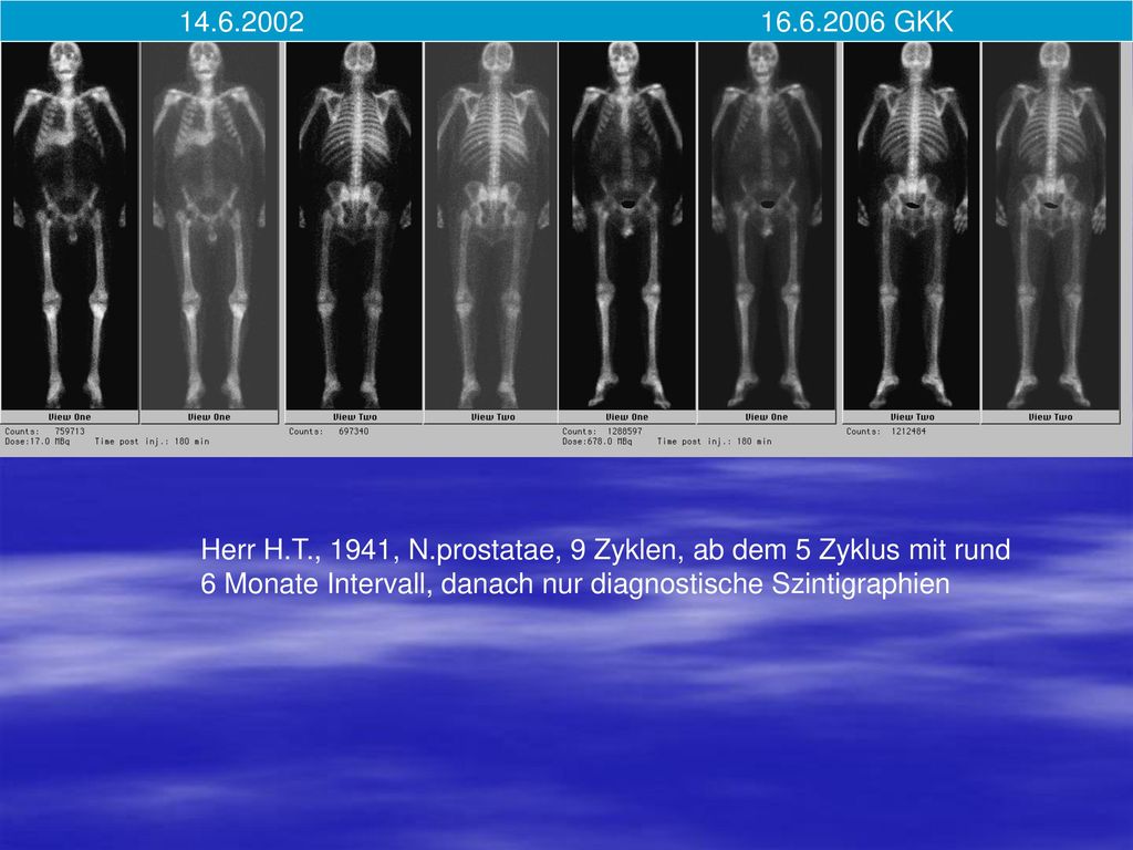 GKK Herr H.T., 1941, N.prostatae, 9 Zyklen, ab dem 5 Zyklus mit rund.