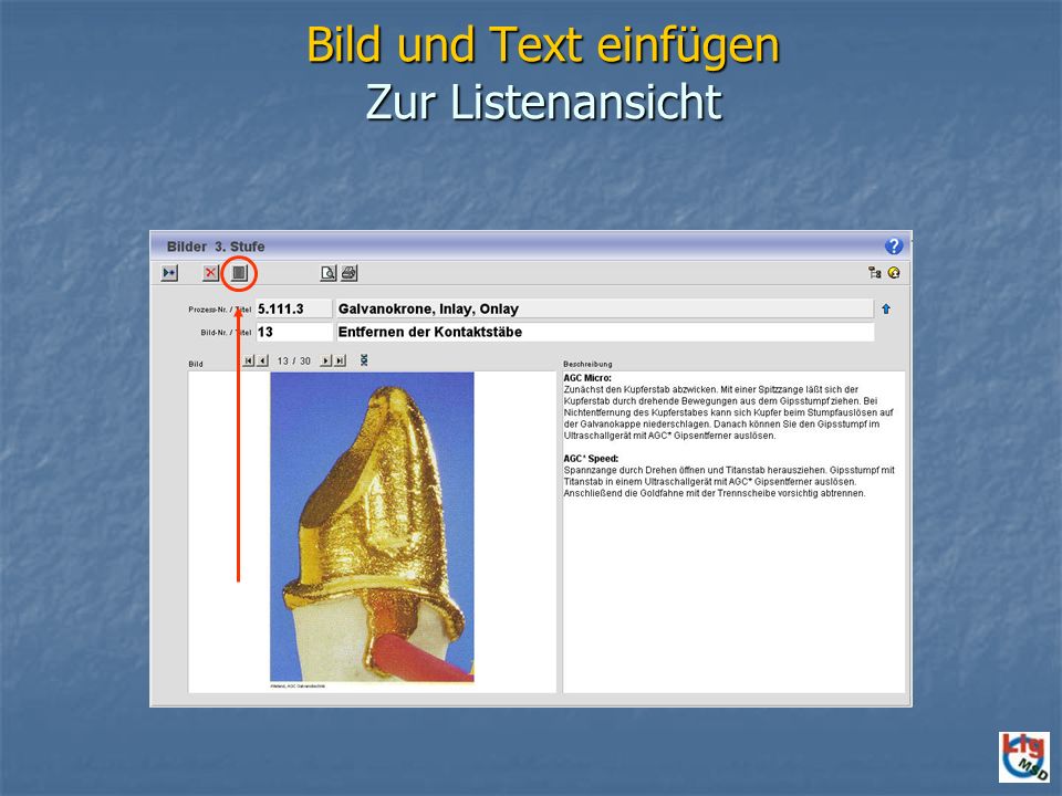 Bild und Text einfügen Zur Listenansicht