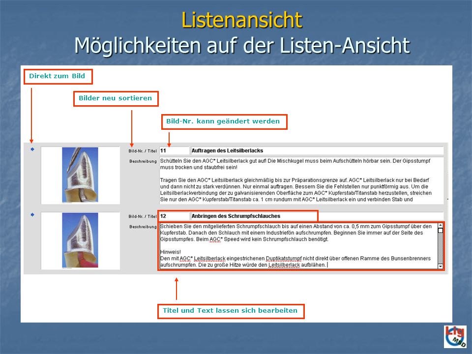 Listenansicht Möglichkeiten auf der Listen-Ansicht
