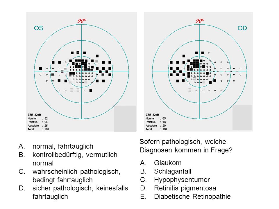 Sofern pathologisch, welche Diagnosen kommen in Frage