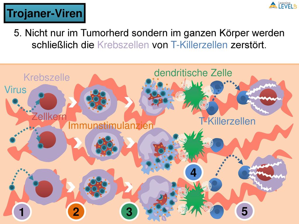 Trojaner-Viren 5. Nicht nur im Tumorherd sondern im ganzen Körper werden schließlich die Krebszellen von T-Killerzellen zerstört.