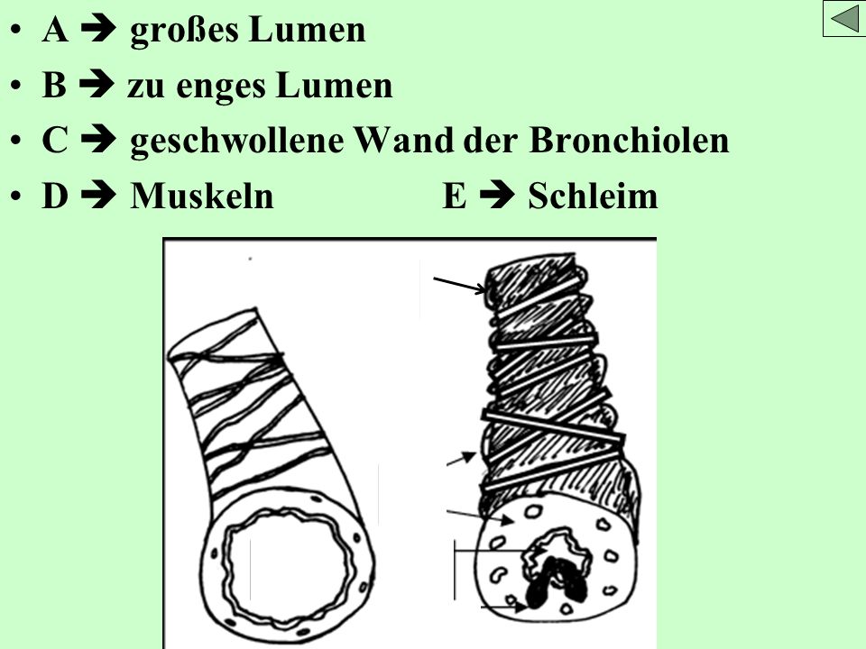 A  großes Lumen B  zu enges Lumen C  geschwollene Wand der Bronchiolen D  Muskeln E  Schleim