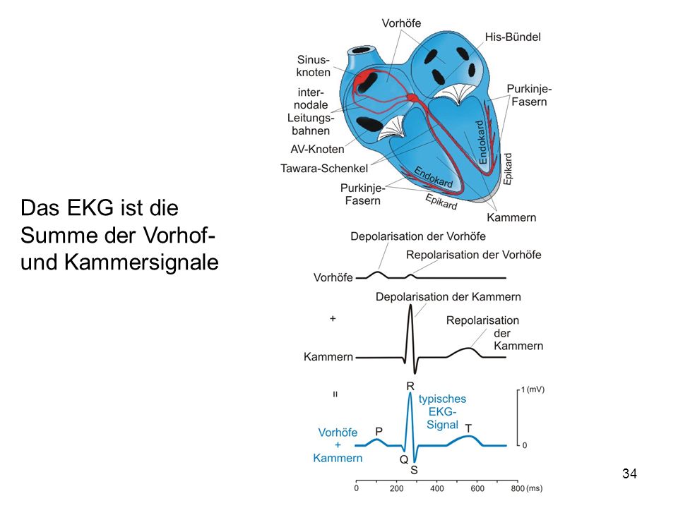 Das EKG ist die Summe der Vorhof- und Kammersignale