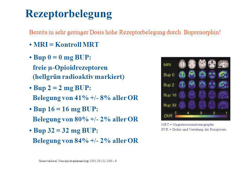 Rezeptorbelegung • MRI = Kontroll MRT • Bup 0 = 0 mg BUP: