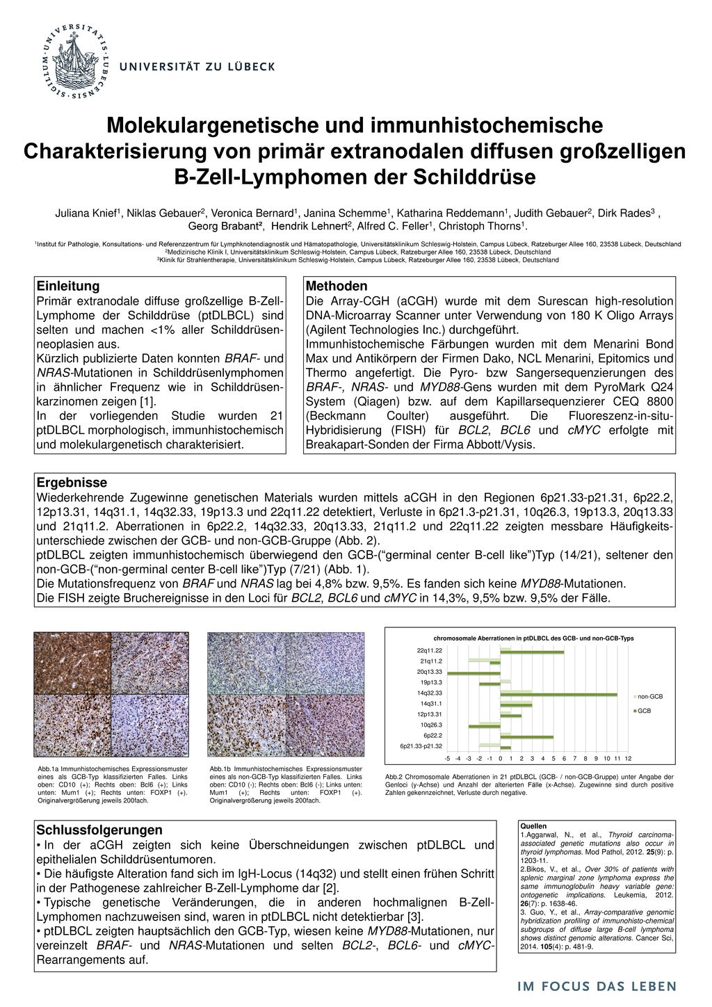 Molekulargenetische und immunhistochemische Charakterisierung von primär extranodalen diffusen großzelligen B-Zell-Lymphomen der Schilddrüse
