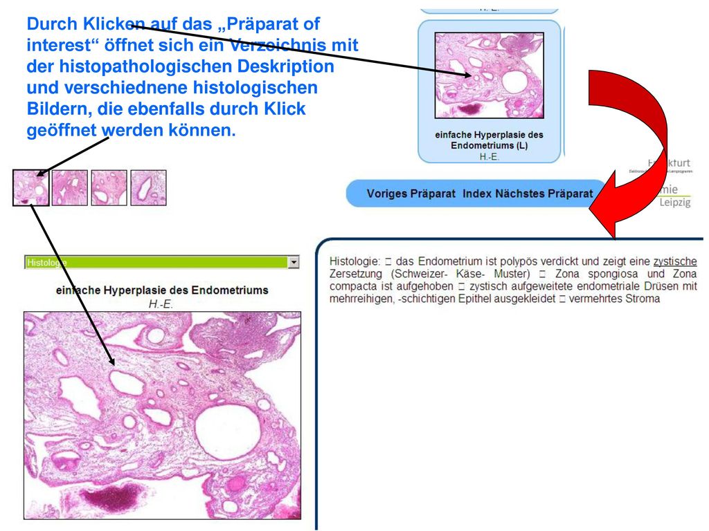 Durch Klicken auf das „Präparat of interest öffnet sich ein Verzeichnis mit der histopathologischen Deskription und verschiednene histologischen Bildern, die ebenfalls durch Klick geöffnet werden können.