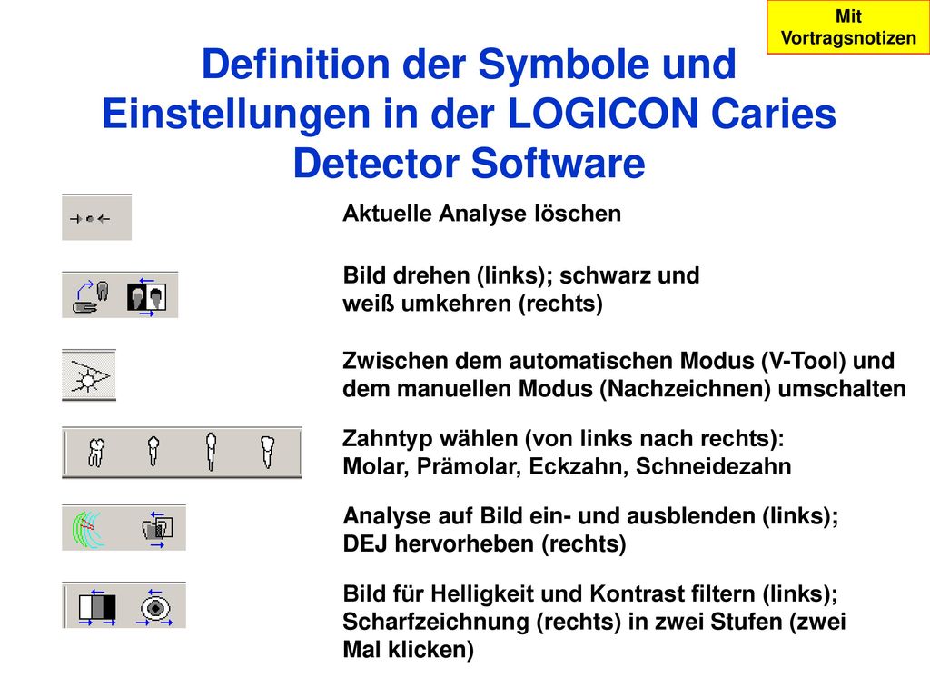 Mit Vortragsnotizen Definition der Symbole und Einstellungen in der LOGICON Caries Detector Software.