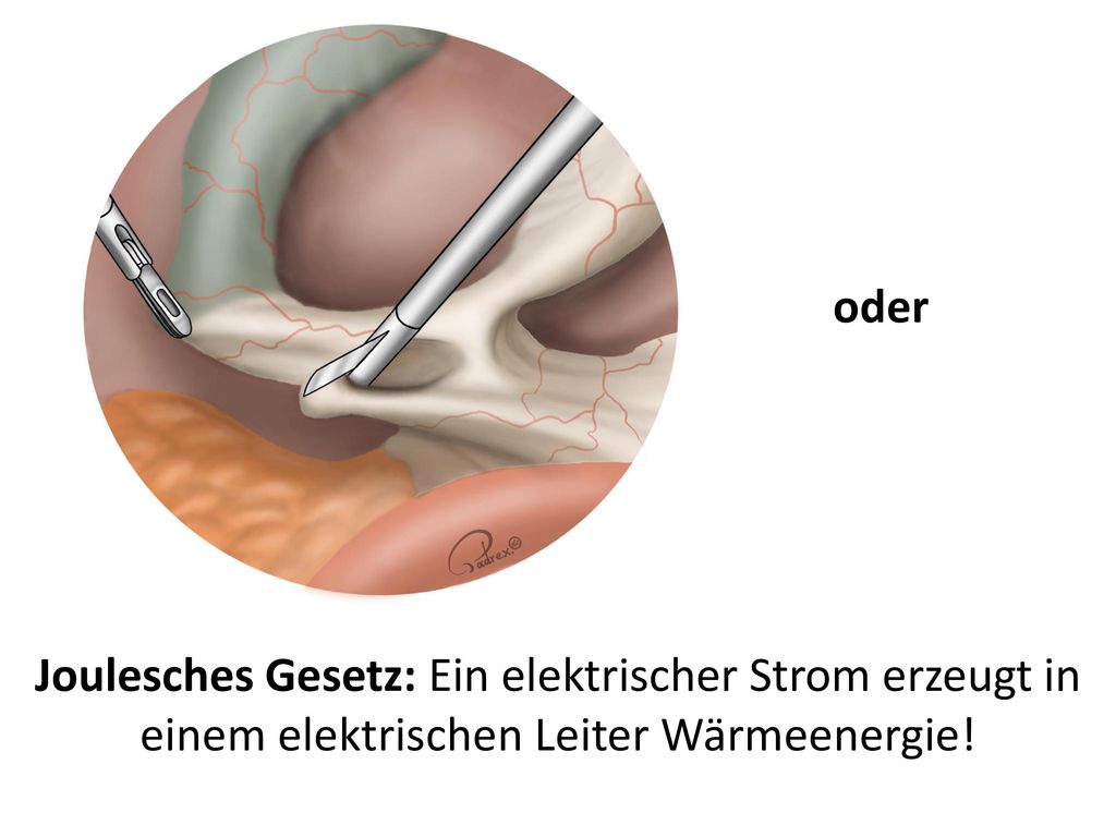 oder Joulesches Gesetz: Ein elektrischer Strom erzeugt in einem elektrischen Leiter Wärmeenergie!