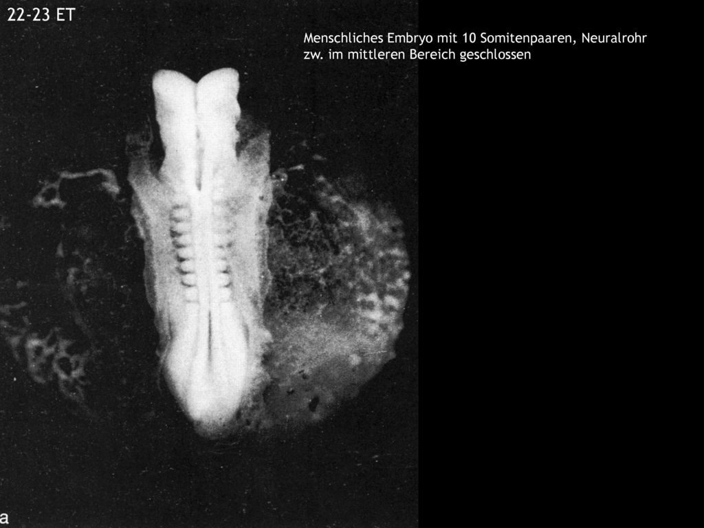 22-23 ET Menschliches Embryo mit 10 Somitenpaaren, Neuralrohr zw. im mittleren Bereich geschlossen.