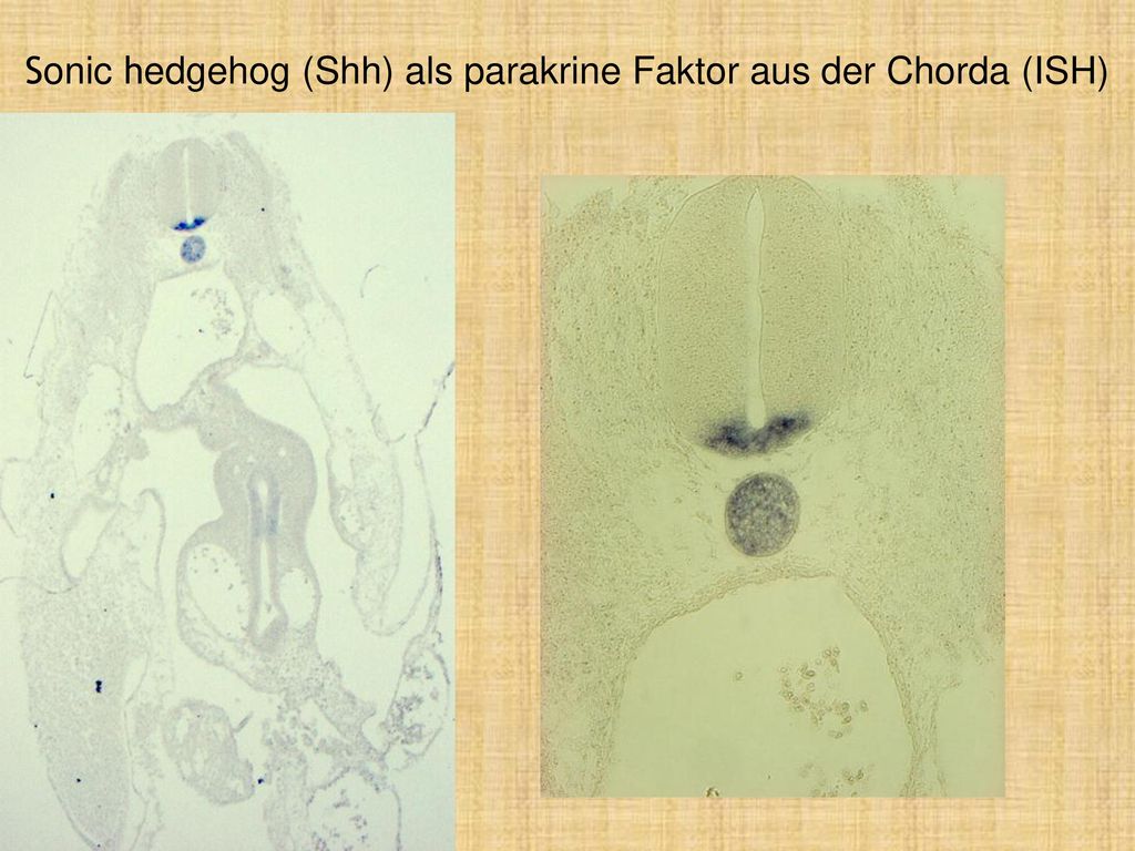 Sonic hedgehog (Shh) als parakrine Faktor aus der Chorda (ISH)