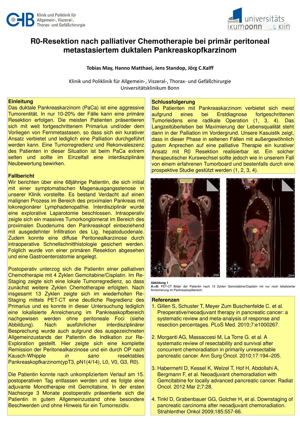 R0-Resektion nach palliativer Chemotherapie bei primär peritoneal metastasiertem duktalen Pankreaskopfkarzinom Tobias May, Hanno Matthaei, Jens Standop, Jörg C.Kalff Klinik und Poliklinik für Allgemein-, Viszeral-, Thorax- und Gefäßchirurgie Universitätsklinikum Bonn