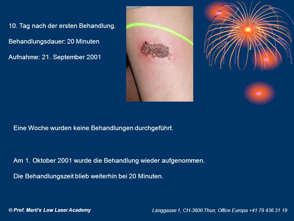10. Tag nach der ersten Behandlung. Behandlungsdauer: 20 Minuten