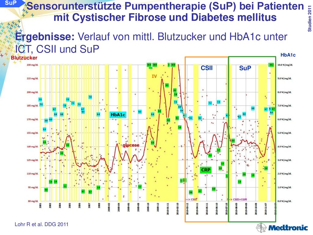 Sensorunterstützte Pumpentherapie (SuP) bei Patienten mit Cystischer Fibrose und Diabetes mellitus