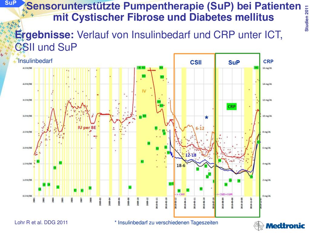 Sensorunterstützte Pumpentherapie (SuP) bei Patienten mit Cystischer Fibrose und Diabetes mellitus