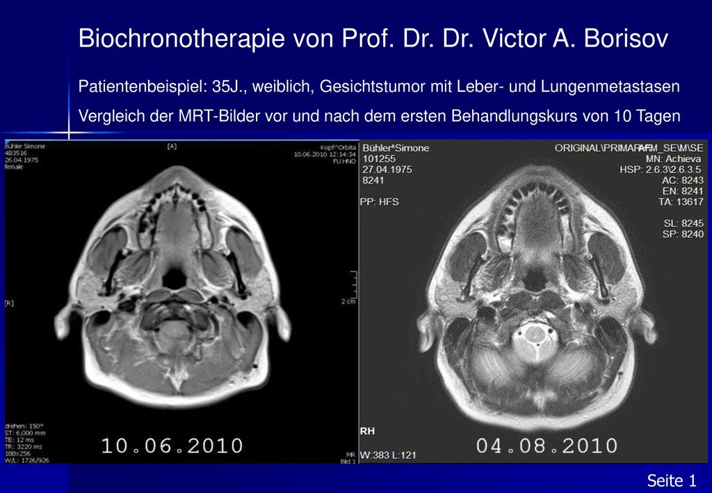 Biochronotherapie von Prof. Dr. Dr. Victor A. Borisov
