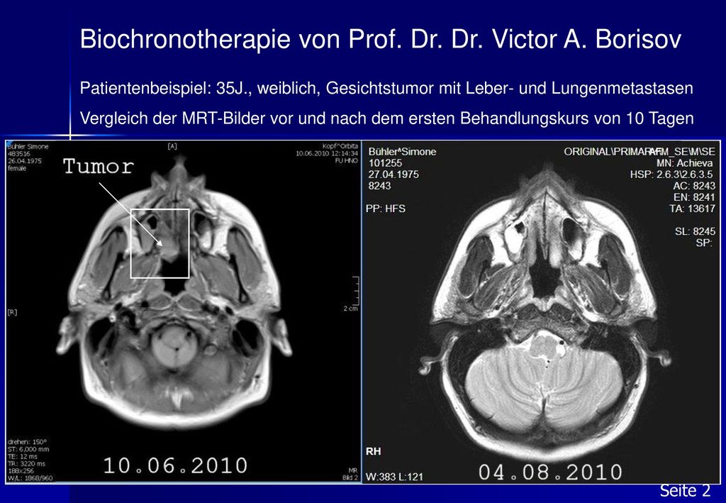 Biochronotherapie von Prof. Dr. Dr. Victor A. Borisov