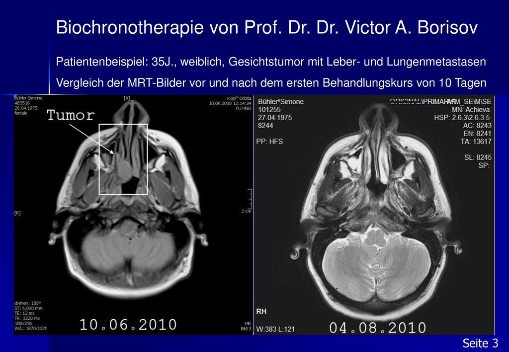 Biochronotherapie von Prof. Dr. Dr. Victor A. Borisov