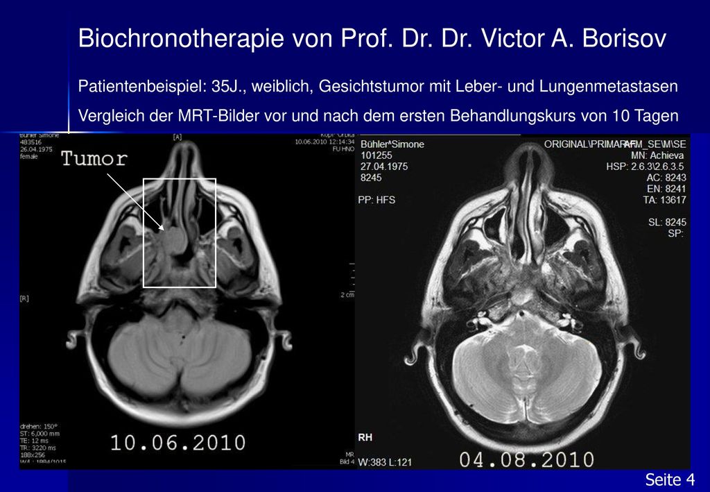 Biochronotherapie von Prof. Dr. Dr. Victor A. Borisov