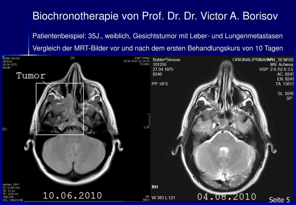 Biochronotherapie von Prof. Dr. Dr. Victor A. Borisov