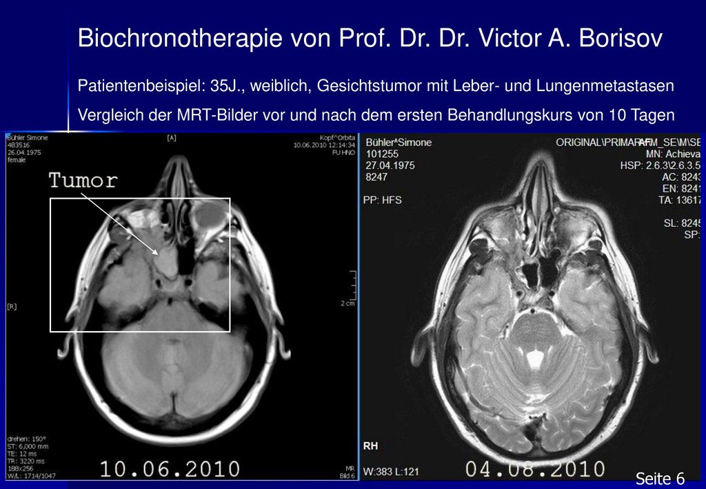 Biochronotherapie von Prof. Dr. Dr. Victor A. Borisov