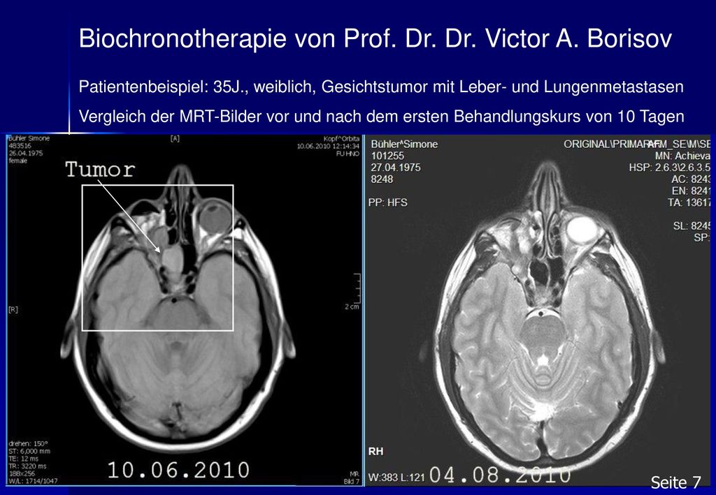 Biochronotherapie von Prof. Dr. Dr. Victor A. Borisov