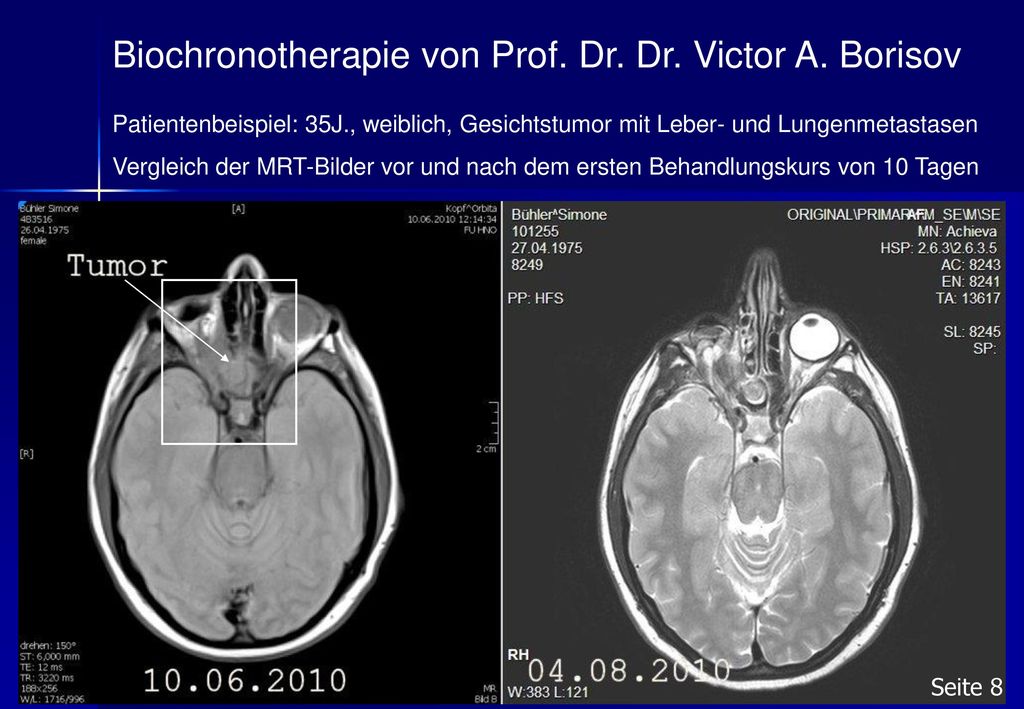 Biochronotherapie von Prof. Dr. Dr. Victor A. Borisov